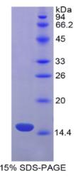 SDS-PAGE (FASLG-624H).jpg